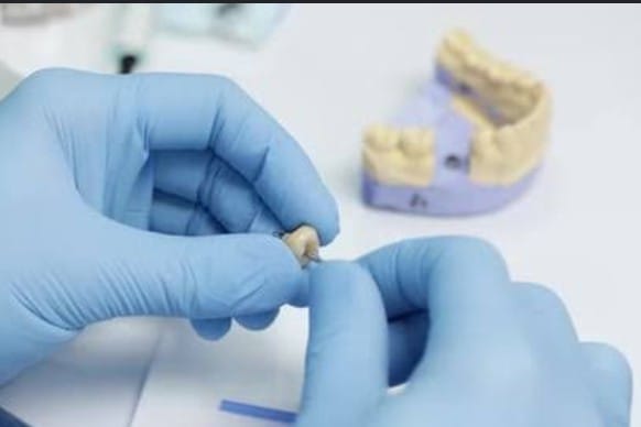 Digital tooth model used in Dentovate's dental laboratory
