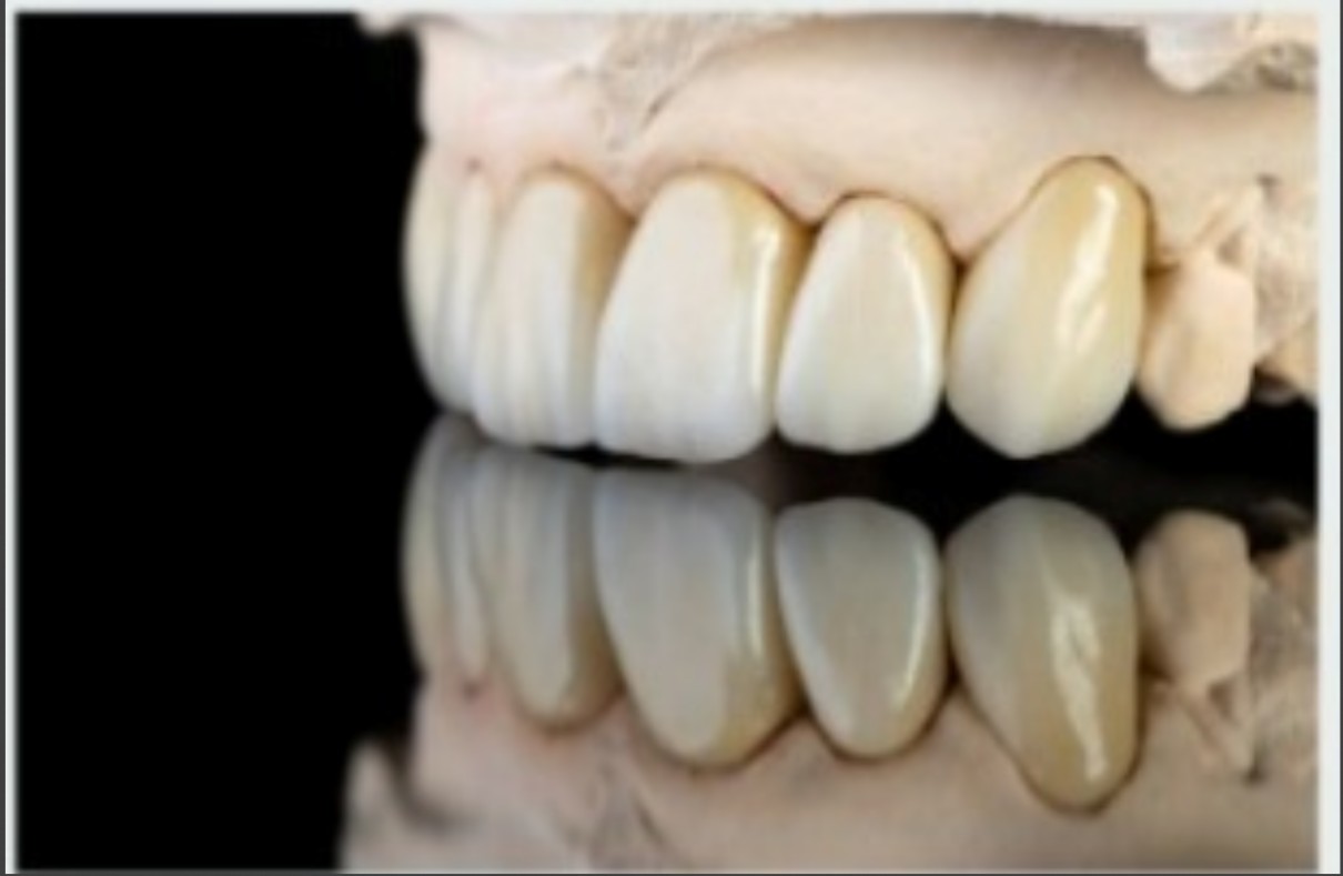 Precision dental laboratory tools